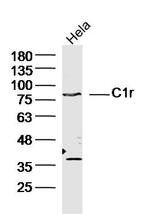 C1r Antibody in Western Blot (WB)