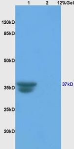 Cathepsin L Antibody in Western Blot (WB)