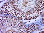 C20orf79 Antibody in Immunohistochemistry (Paraffin) (IHC (P))