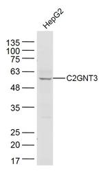 C2GNT3 Antibody in Western Blot (WB)