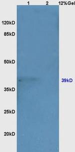 NeuroD1 Antibody in Western Blot (WB)