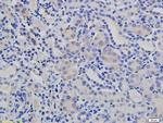 pan Cadherin Antibody in Immunohistochemistry (Paraffin) (IHC (P))