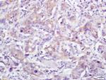 pan Cadherin Antibody in Immunohistochemistry (Paraffin) (IHC (P))