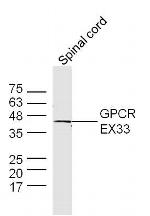 GPCR EX33 Antibody in Western Blot (WB)