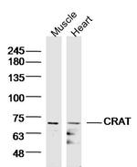 CRAT/CAT1 Antibody in Western Blot (WB)