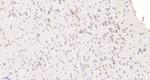 CHIP Antibody in Immunohistochemistry (Paraffin) (IHC (P))