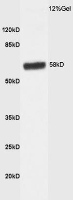 HBP1 Antibody in Western Blot (WB)