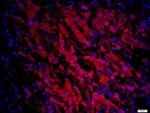 CCR6/CD196 Antibody in Immunohistochemistry (Paraffin) (IHC (P))