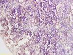 CCR6/CD196 Antibody in Immunohistochemistry (Paraffin) (IHC (P))