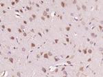 HDPTP Antibody in Immunohistochemistry (Paraffin) (IHC (P))