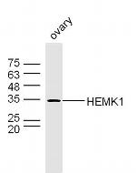 HEMK1 Antibody in Western Blot (WB)