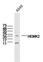 HEMK2 Antibody in Western Blot (WB)