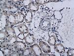 TPA Antibody in Immunohistochemistry (Paraffin) (IHC (P))