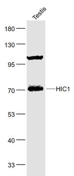 HIC1 Antibody in Western Blot (WB)