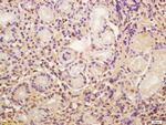 CDC5L Antibody in Immunohistochemistry (Paraffin) (IHC (P))