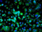 Ubiquitin Antibody in Immunocytochemistry (ICC/IF)