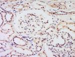 Bcl-2 Antibody in Immunohistochemistry (Paraffin) (IHC (P))