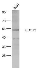 SCOT2 Antibody in Western Blot (WB)