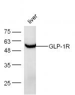 GLP-1R Antibody in Western Blot (WB)