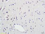 DTNBP1 Antibody in Immunohistochemistry (Paraffin) (IHC (P))