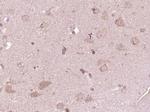 ATP7A Antibody in Immunohistochemistry (Paraffin) (IHC (P))