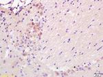 PUMA Antibody in Immunohistochemistry (Paraffin) (IHC (P))