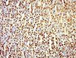 Phospho-alpha Adducin (Ser436) Antibody in Immunohistochemistry (Paraffin) (IHC (P))