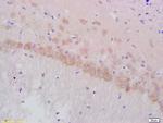 Gamma-Adaptin Antibody in Immunohistochemistry (Paraffin) (IHC (P))