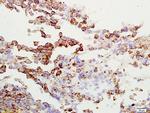 Gamma-Adaptin Antibody in Immunohistochemistry (Paraffin) (IHC (P))