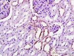 Gamma-Adaptin Antibody in Immunohistochemistry (Paraffin) (IHC (P))