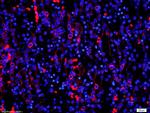 PDCD4 Antibody in Immunohistochemistry (Paraffin) (IHC (P))