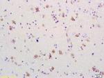 PDCD4 Antibody in Immunohistochemistry (Paraffin) (IHC (P))