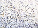 LI-cadherin Antibody in Immunohistochemistry (Paraffin) (IHC (P))