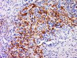 GAL3ST4 Antibody in Immunohistochemistry (Paraffin) (IHC (P))