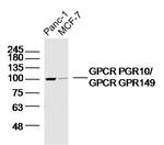 GPR149 Antibody in Western Blot (WB)