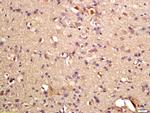 Phospho-GRLF1 (Tyr1087) Antibody in Immunohistochemistry (Paraffin) (IHC (P))