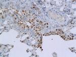 B3GAT1/CD57 Antibody in Immunohistochemistry (Paraffin) (IHC (P))