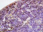 Antithrombin 3 Antibody in Immunohistochemistry (Paraffin) (IHC (P))