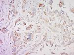 SMAD1 Antibody in Immunohistochemistry (Paraffin) (IHC (P))