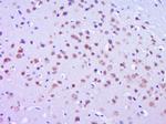 Phospho-FAK (Tyr577) Antibody in Immunohistochemistry (Paraffin) (IHC (P))