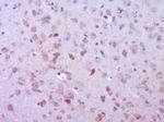 Phospho-FAK (Ser732) Antibody in Immunohistochemistry (Paraffin) (IHC (P))