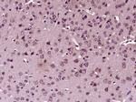 Phospho-STAT1 (Tyr701) Antibody in Immunohistochemistry (Paraffin) (IHC (P))