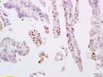 Phospho-STAT3 (Tyr705) Antibody in Immunohistochemistry (Paraffin) (IHC (P))