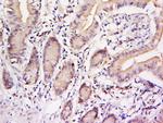 Phospho-STAT3 (Tyr705) Antibody in Immunohistochemistry (Paraffin) (IHC (P))