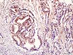 Phospho-STAT3 (Tyr705) Antibody in Immunohistochemistry (Paraffin) (IHC (P))