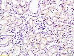 Cathepsin H/CTSH Antibody in Immunohistochemistry (Paraffin) (IHC (P))