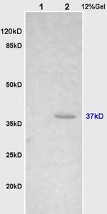 Cathepsin H/CTSH Antibody in Western Blot (WB)