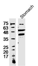 TREX2 Antibody in Immunohistochemistry (Paraffin) (IHC (P))