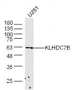 KLHDC7B Antibody in Western Blot (WB)