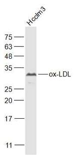 ox-LDL Antibody in Western Blot (WB)